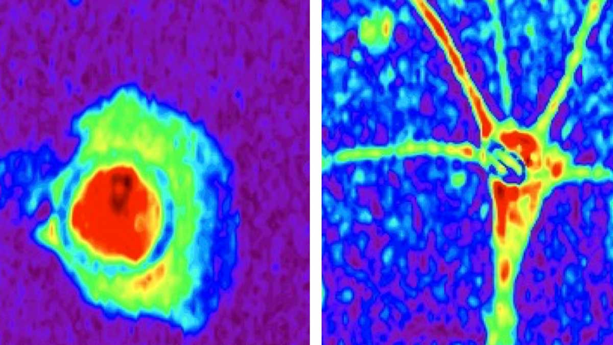 Una nuova mappa molecolare per leggere il cervello
